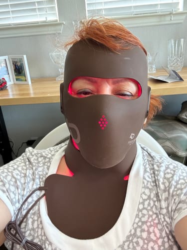 Customer photo review of JOVS 4D Laser Light Therapy Mask