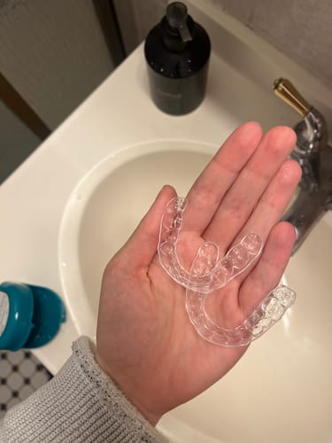 Customer photo review of Upper and Lower Retainers Set