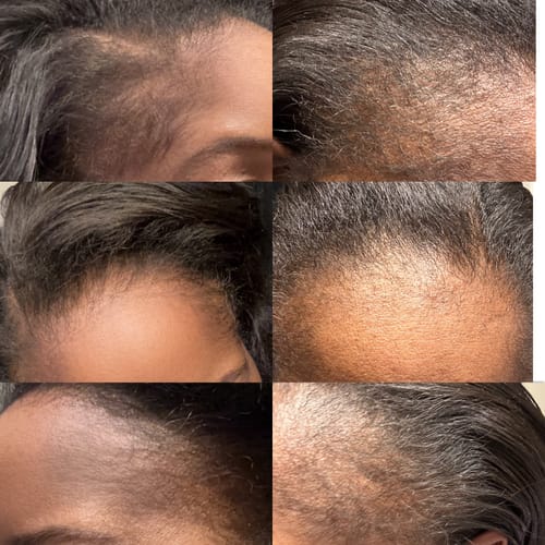 Customer photo review of 100% Unrefined Batana Oil 4 oz