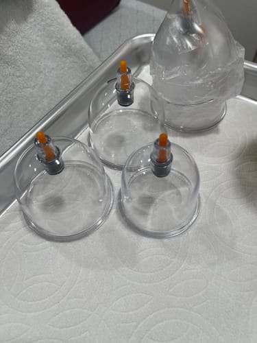 Customer photo review of Premium Cupping Cups - Mixed Sizes from B1 to B6
