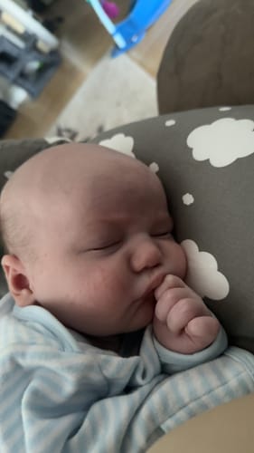 Customer photo review of All Over Ointment Original