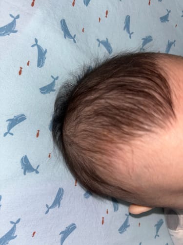 Customer photo review of Bye-Bye Cradle Cap