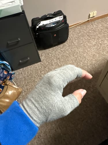 Customer photo review of Premium Onecompress™ Gloves