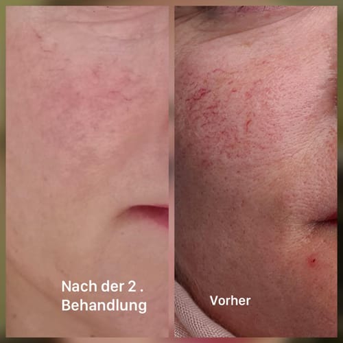 Customer photo review of SQT mittleres Starterset inkl. Online Schulung