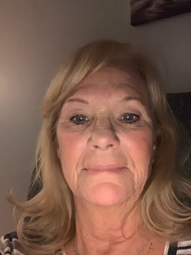 Customer photo review of Glov Micro Infusion System