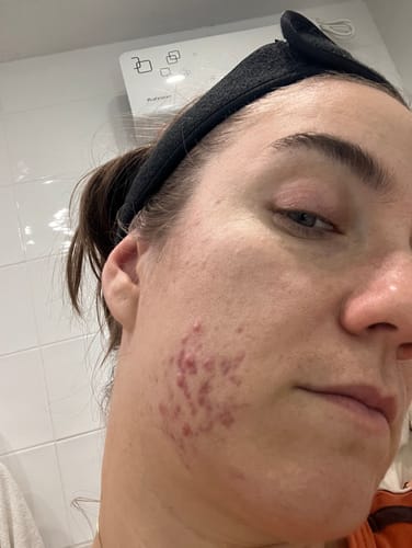 Customer photo review of Radiance Powder