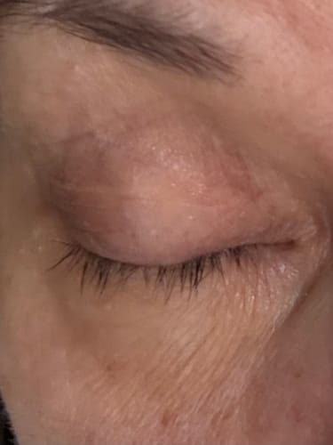 Customer photo review of EYELASH GROWTH SOLUTION