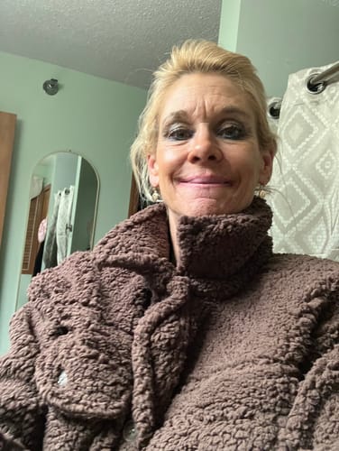 Customer photo review of Glov Micro Infusion System