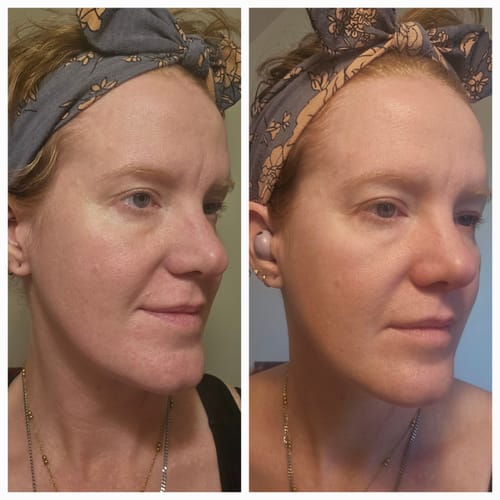 Customer photo review of The Complete System for Mature Women’s Skin