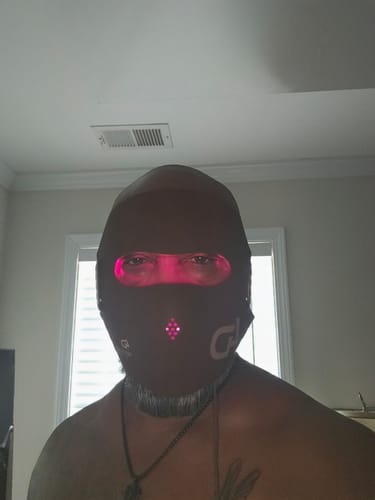 Customer photo review of JOVS 4D Laser Light Therapy Mask