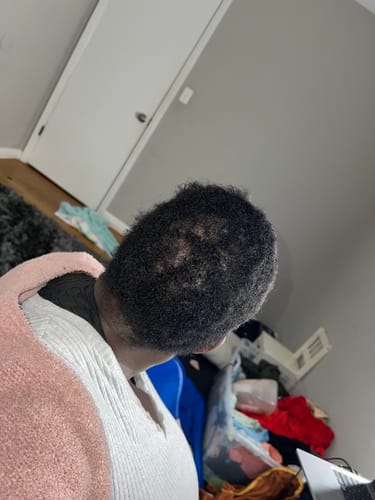 Customer photo review of NATURAL SHAMPOO & CONDITIONER - 8 fl oz