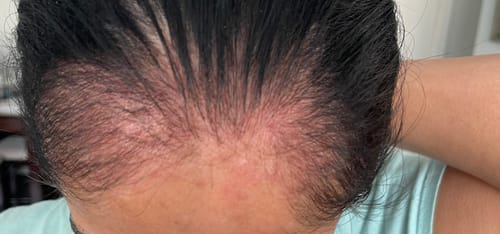 Customer photo review of Flowering Hair Serum