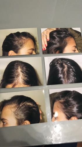 Customer photo review of Hair Growth Oil