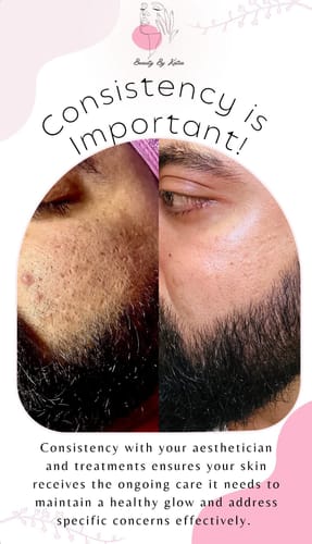 Customer photo review of Zena ExoBoost Ampoules