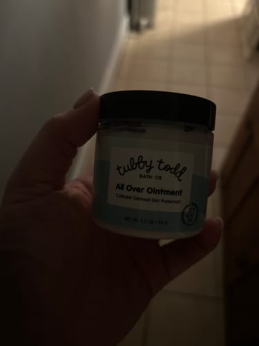 Customer photo review of All Over Ointment Eczema Treatment