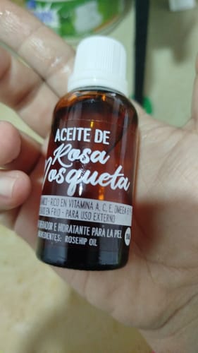 Customer photo review of Aceite de Rosa Mosqueta