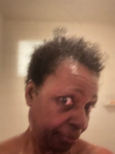 Customer photo review of HOLISTIC NATURAL PROTEIN TREATMENT FOR DAMAGED HAIR 16 oz