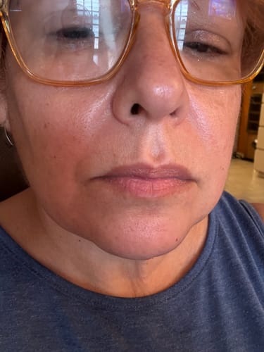 Customer photo review of Luxury Skincare Box