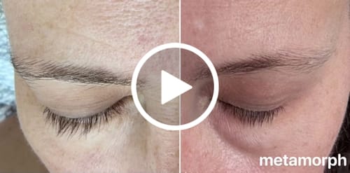 Customer video review of LASH SERUM