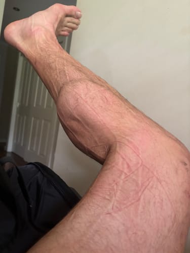 Customer photo review of WIRELESS Compression Boots 3.0