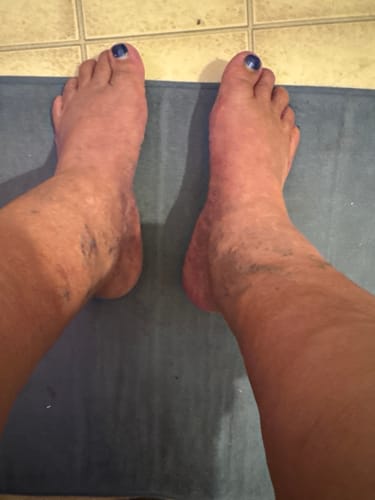 Customer photo review of 6 Pack - Mama Bear Nerve Relief Lotion