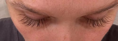 Customer photo review of Toplash eyelash and eyebrow growth serum — 3ml