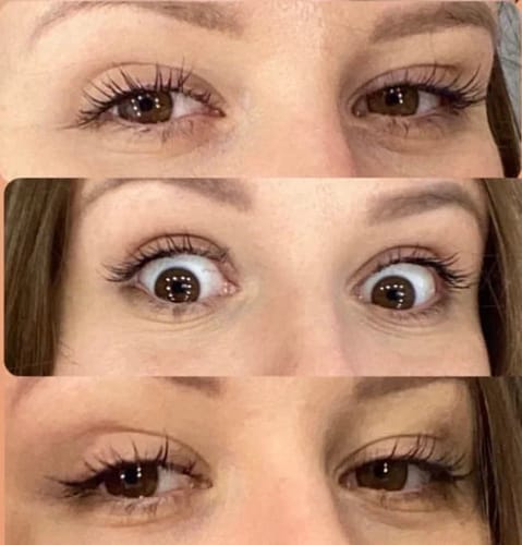 Customer photo review of Toplash eyelash and eyebrow growth serum — 3ml