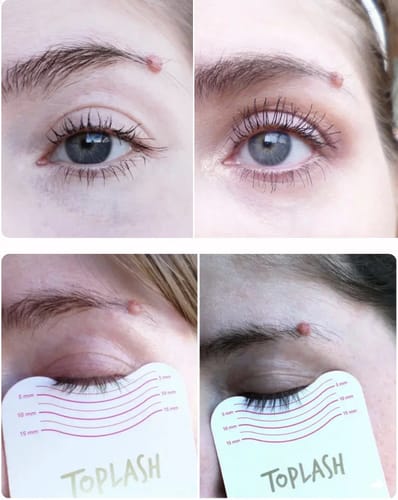 Customer photo review of Toplash eyelash and eyebrow growth serum — 3ml