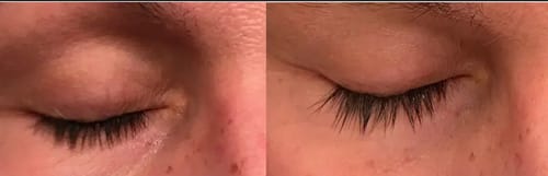 Customer photo review of Toplash eyelash and eyebrow growth serum — 3ml