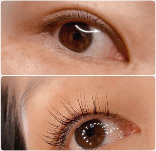 Customer photo review of Toplash eyelash and eyebrow growth serum — 3ml