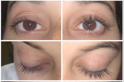 Customer photo review of Toplash eyelash and eyebrow growth serum — 3ml
