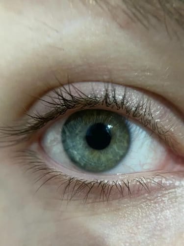 Customer photo review of Toplash eyelash and eyebrow growth serum — 3ml
