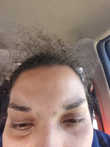 Customer photo review of ILUUMI PRO