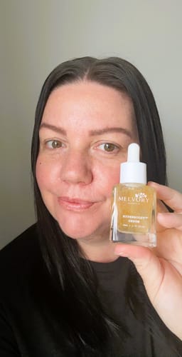 Customer photo review of Vitamin C 10% HYPERBOOST® Serum