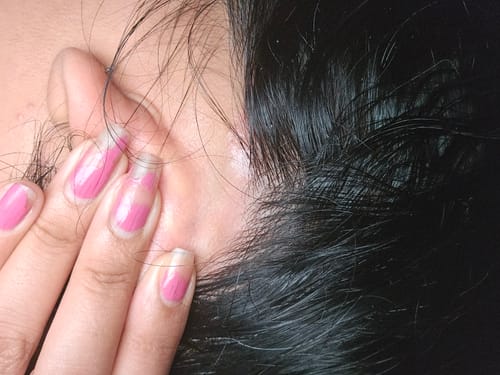 Customer photo review of Seb Natural Calming Serum