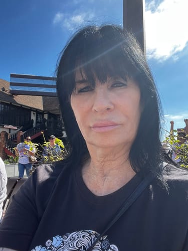 Customer photo review of 3 Month Supply - Seranova Micro Infusion System