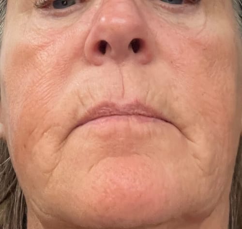 Customer photo review of Ageless Cloud Cream