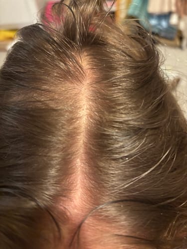Customer photo review of Seb Natural Calming Serum