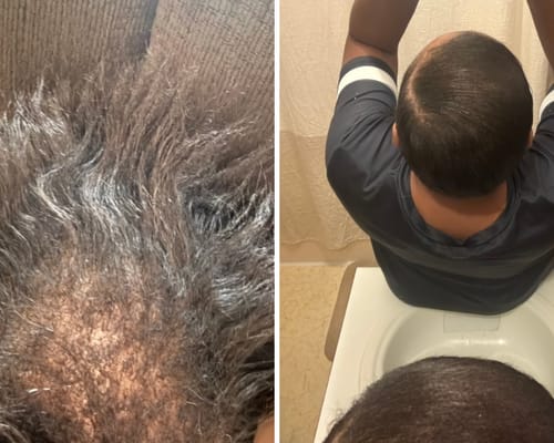 Customer photo review of 2 oz HAIR & SCALP GROWTH OIL