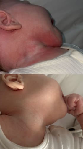 Customer photo review of Calm Balm