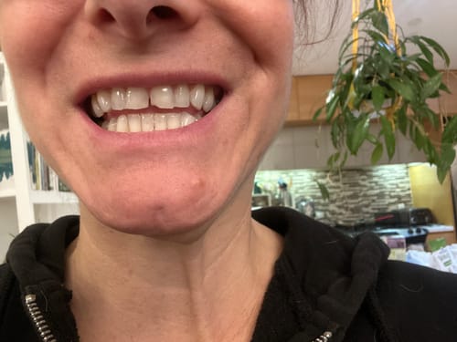 Customer photo review of Fluoride-free Toothpaste with Natural Hydroxyapatite