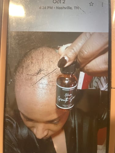 Customer photo review of Rennora Hair Growth Serum