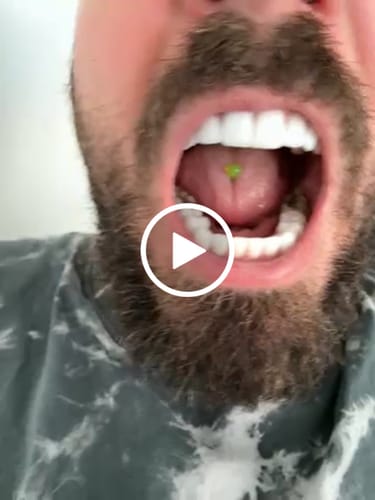 Customer video review of Pro-Repair Mundgel