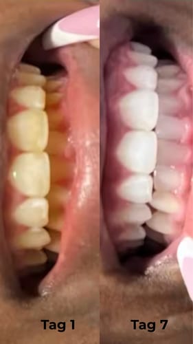 Customer photo review of Pro-Repair Mundgel