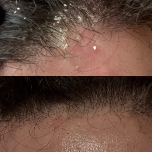 Customer photo review of Seb Natural Calming Serum