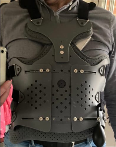 Customer photo review of Full Back Straightening TLSO Spine Kyphosis/Scoliosis Brace