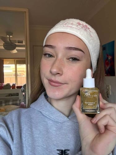 Customer photo review of Vitamin C 10% HYPERBOOST® Serum
