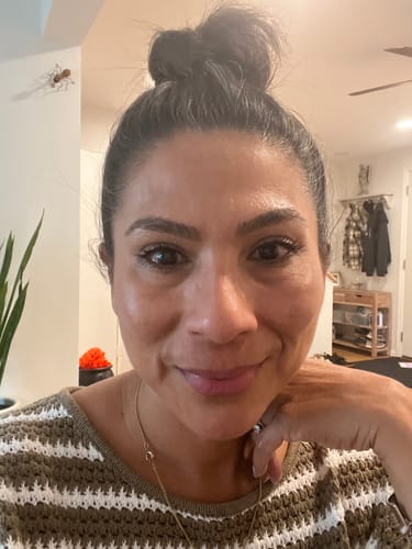 Customer photo review of 3 Month Supply - Seranova Micro Infusion System