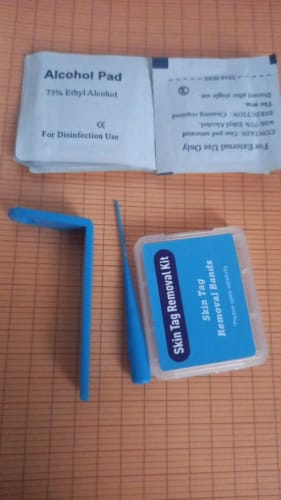 Customer photo review of LumiClear™ – Removedor de Verrugas Avanzado