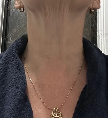 Customer photo review of Ageless Wonder